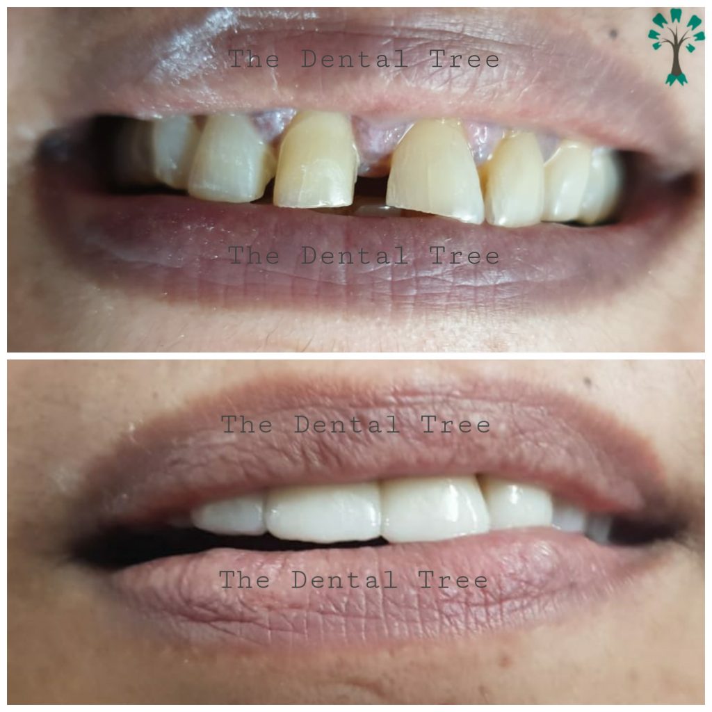 Best Dental Clinic In Indirapuram