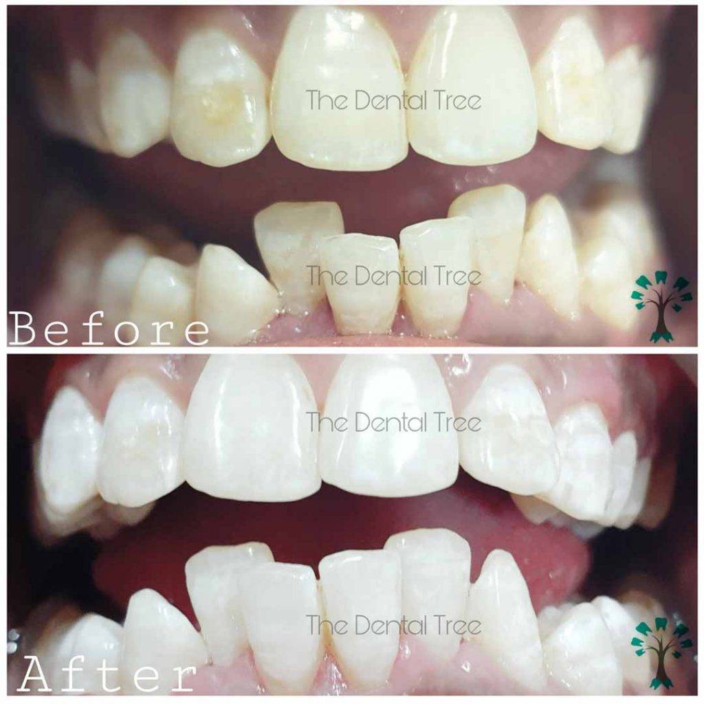 Best Dental Clinic In Indirapuram