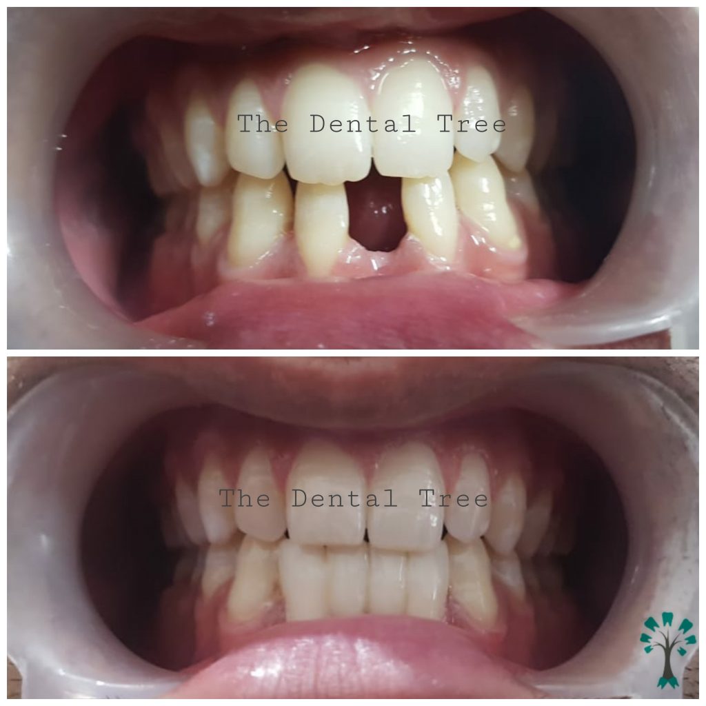 Best Dental Clinic In Indirapuram