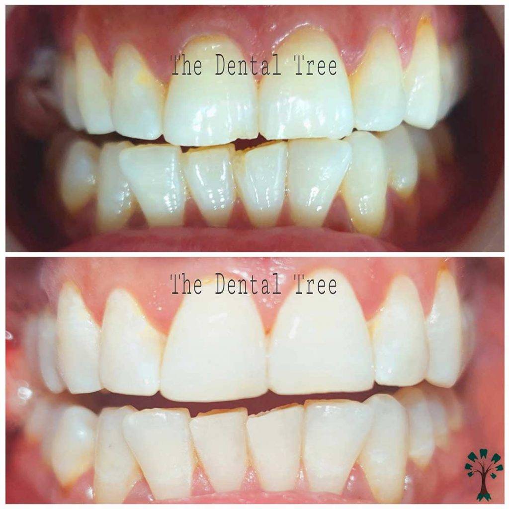 Best Dental Clinic In Indirapuram