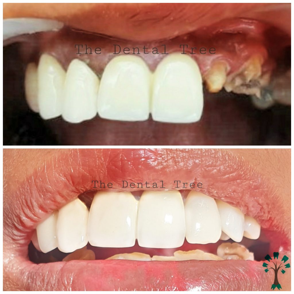 Best Dental Clinic In Indirapuram