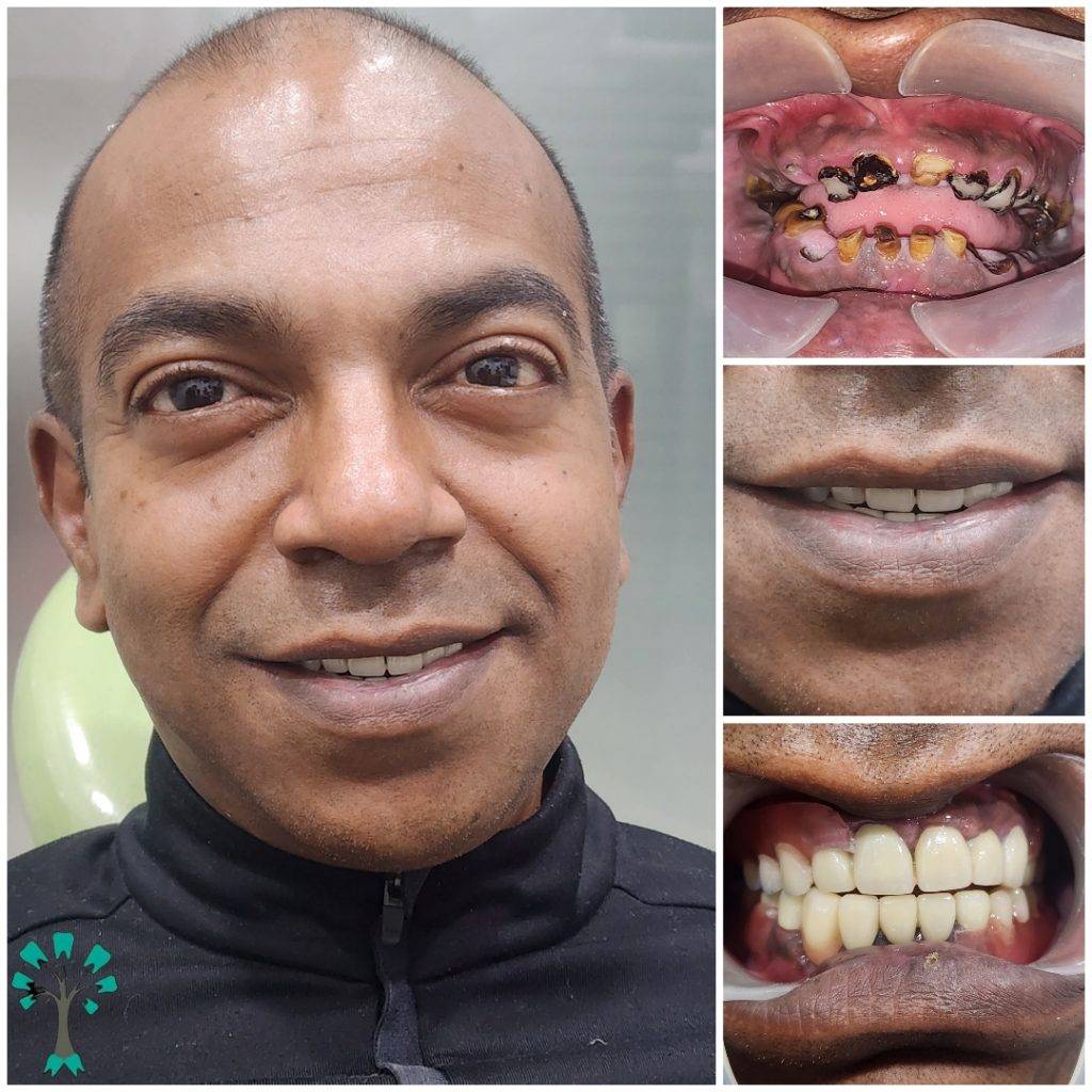 treatment-before-after (1)